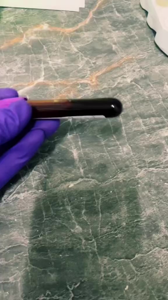 @ALab 🔬💉🩸
