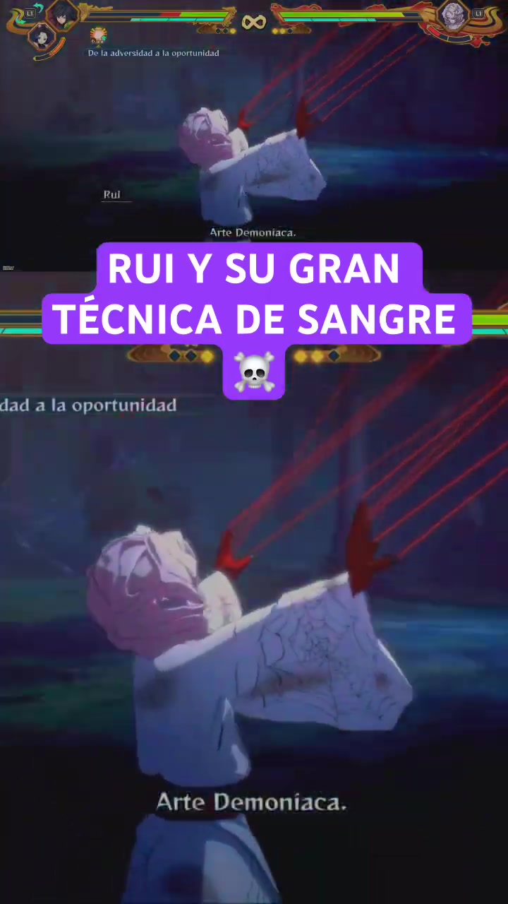 @Animebetx
