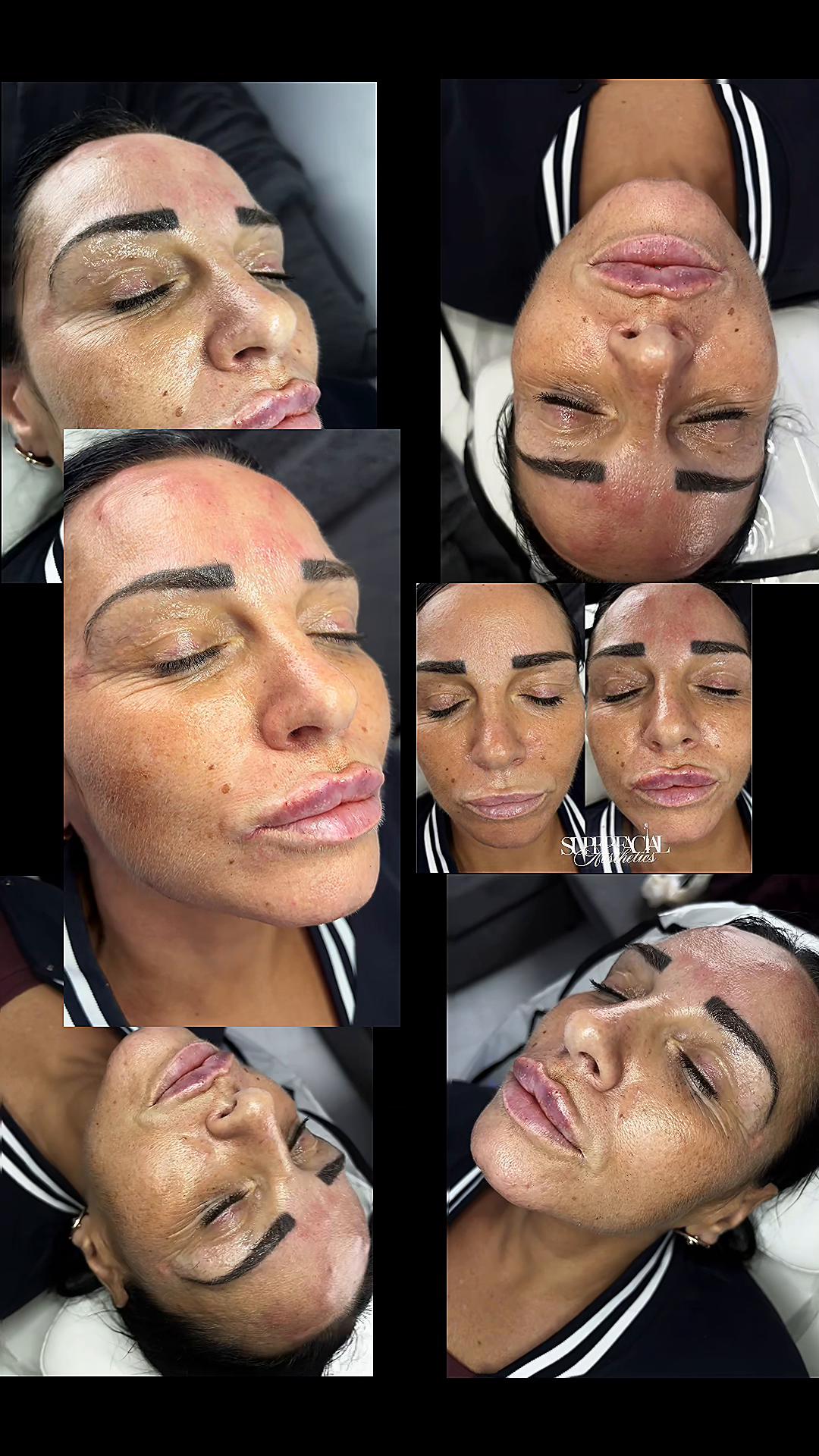@Superfacial Aesthetics