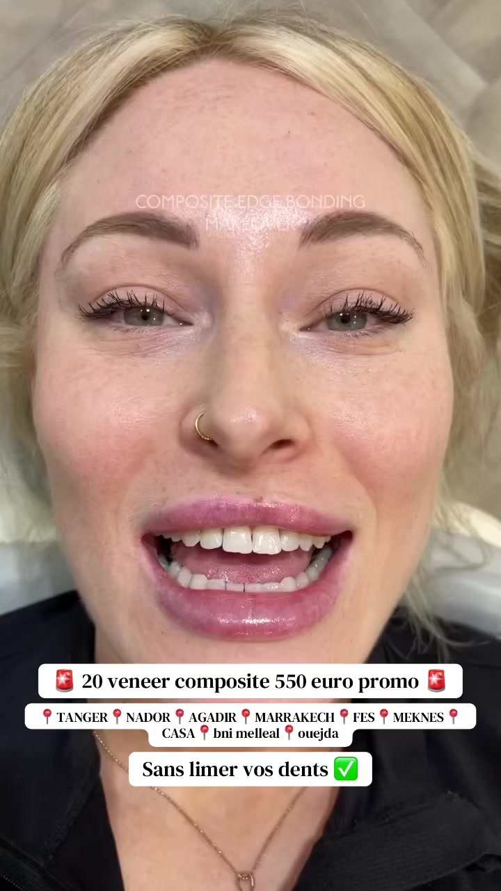 @brightsmileee1