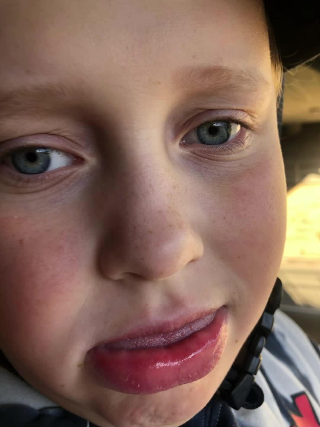 @.