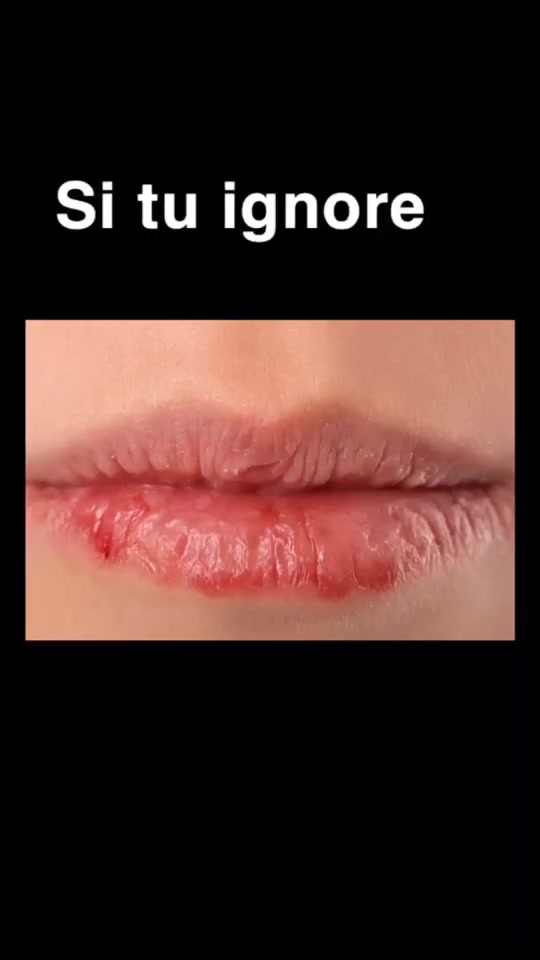 @โค๏ธ ๐๐/๐๐/๐๐ก ๐