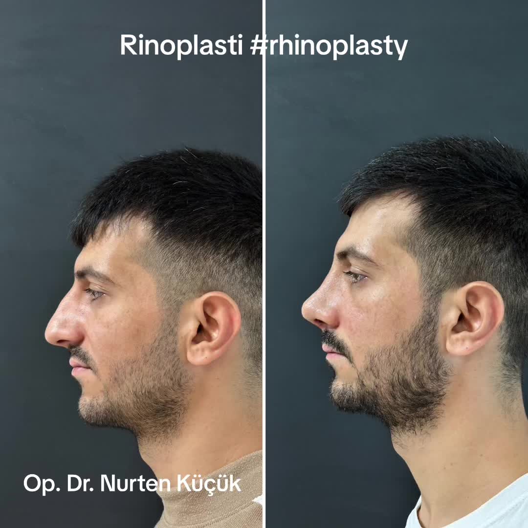 @Dr. NurtenKucuk