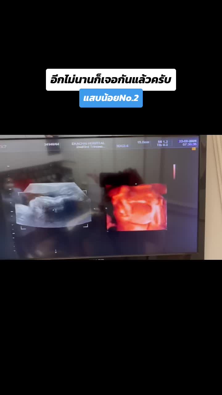@beginning2086