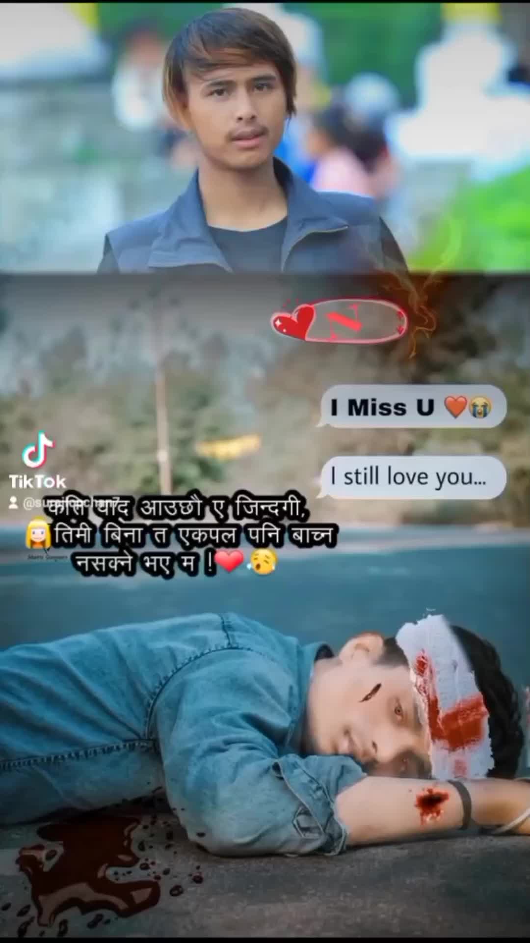 @Suraj lopchan