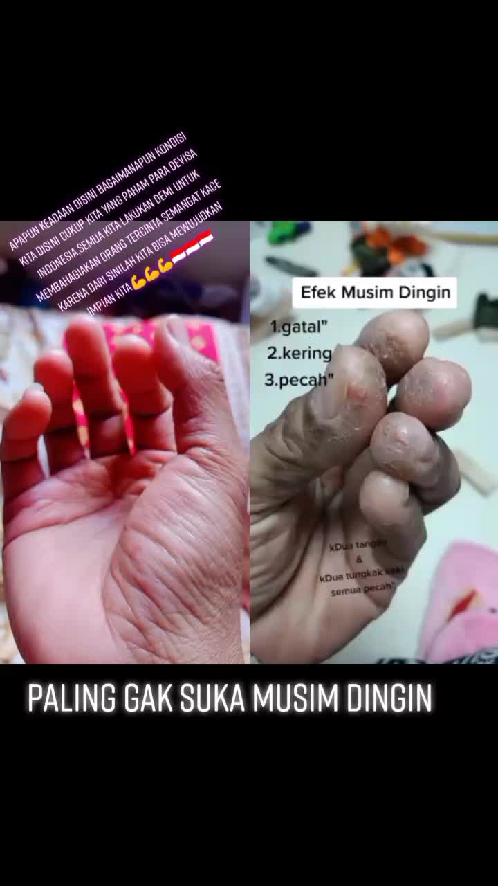 @ekha dewy