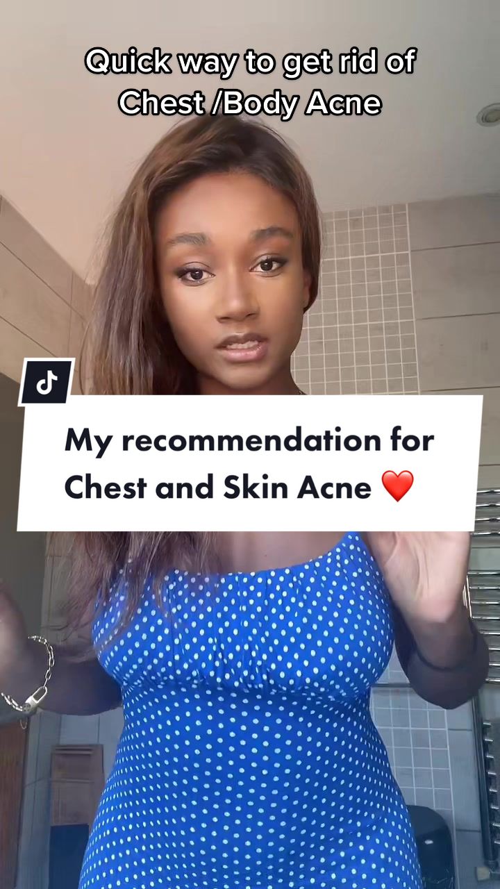 @Abi M