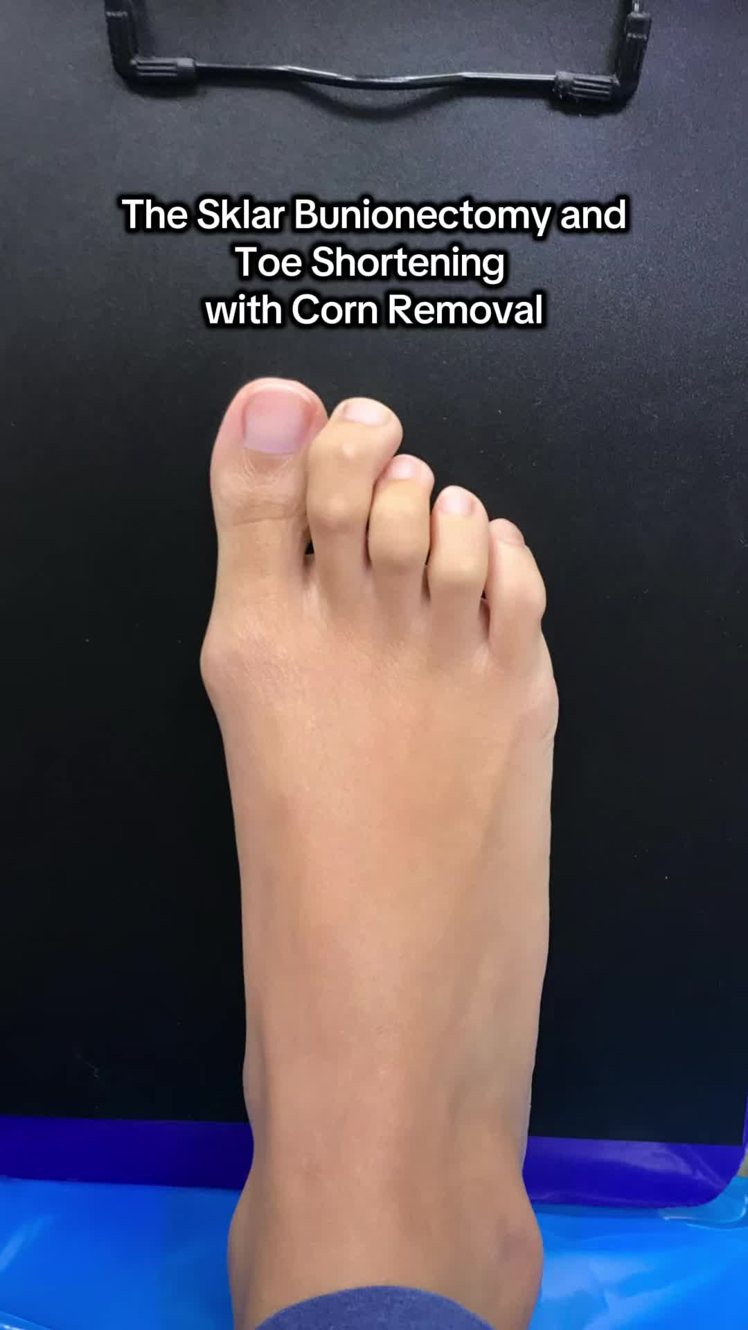 @Foot First Podiatry