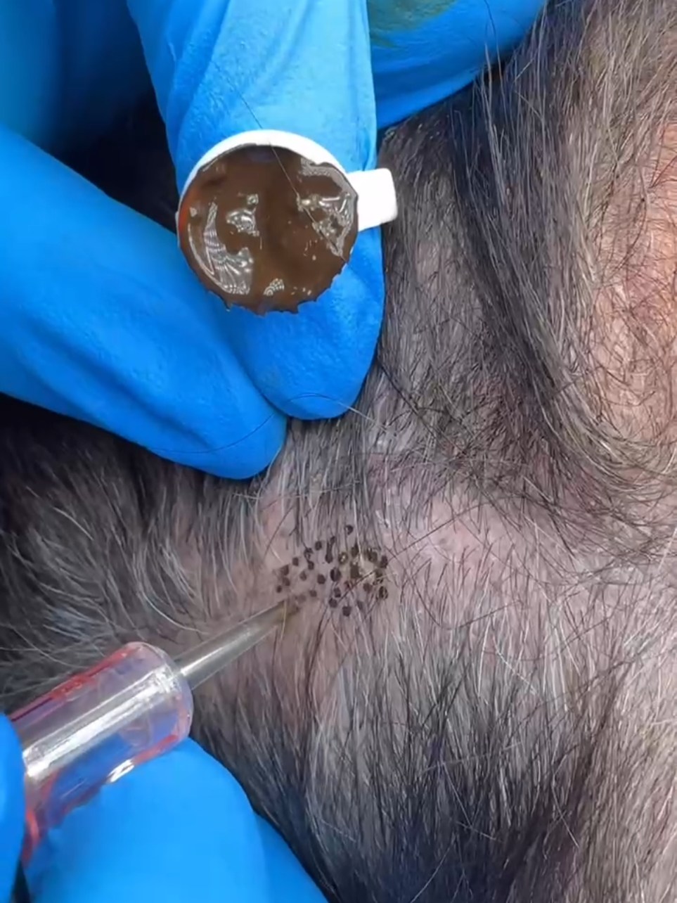 @nanoscalpeyvaz