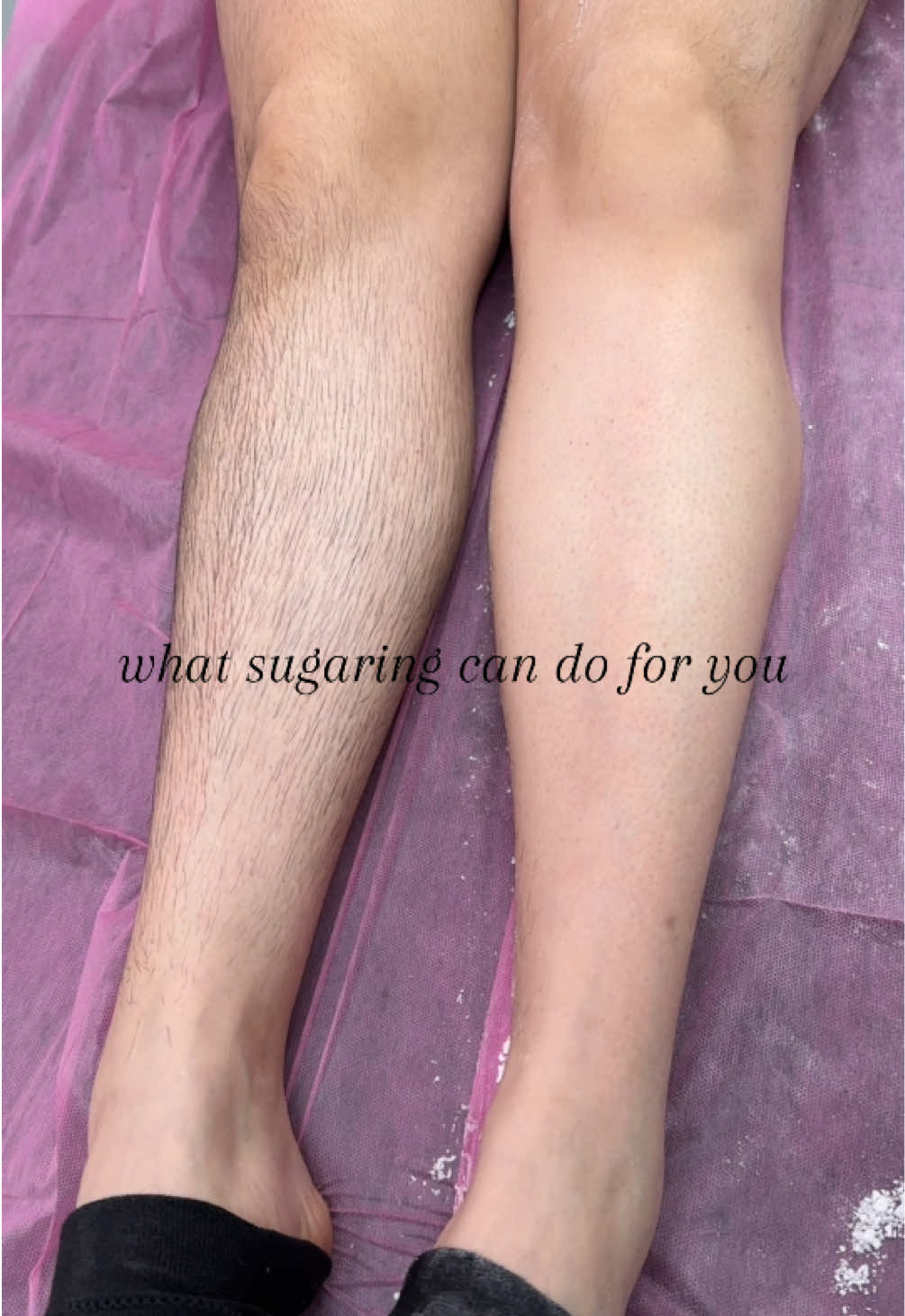@All Natural Hair Removal