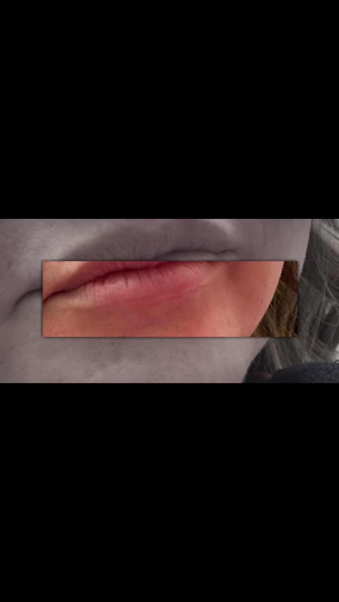 @Esteem Aesthetics