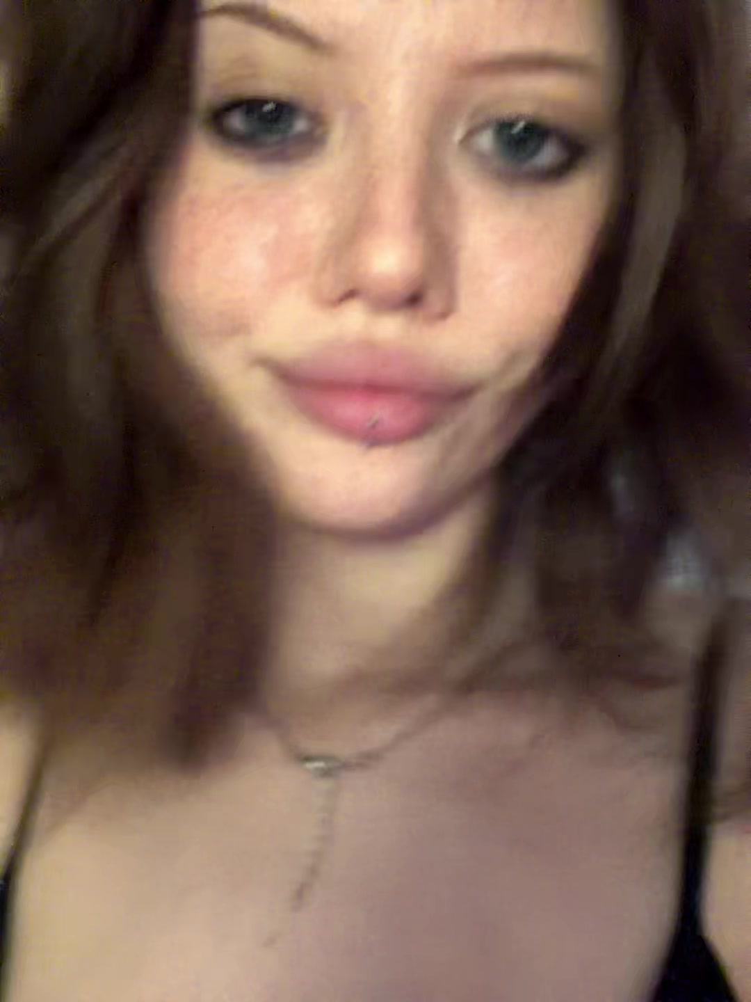 @глаукома