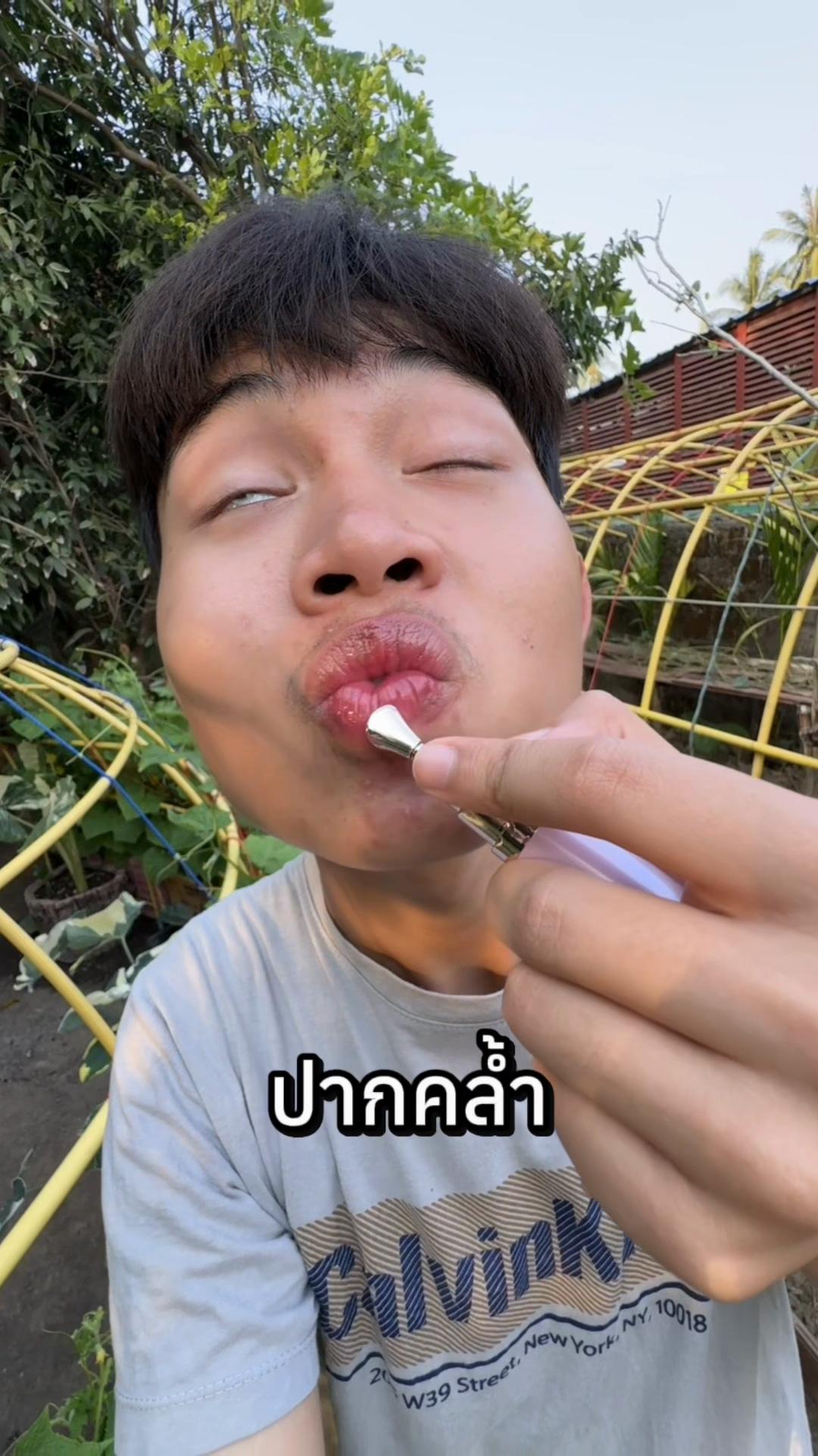@มิกสิว!