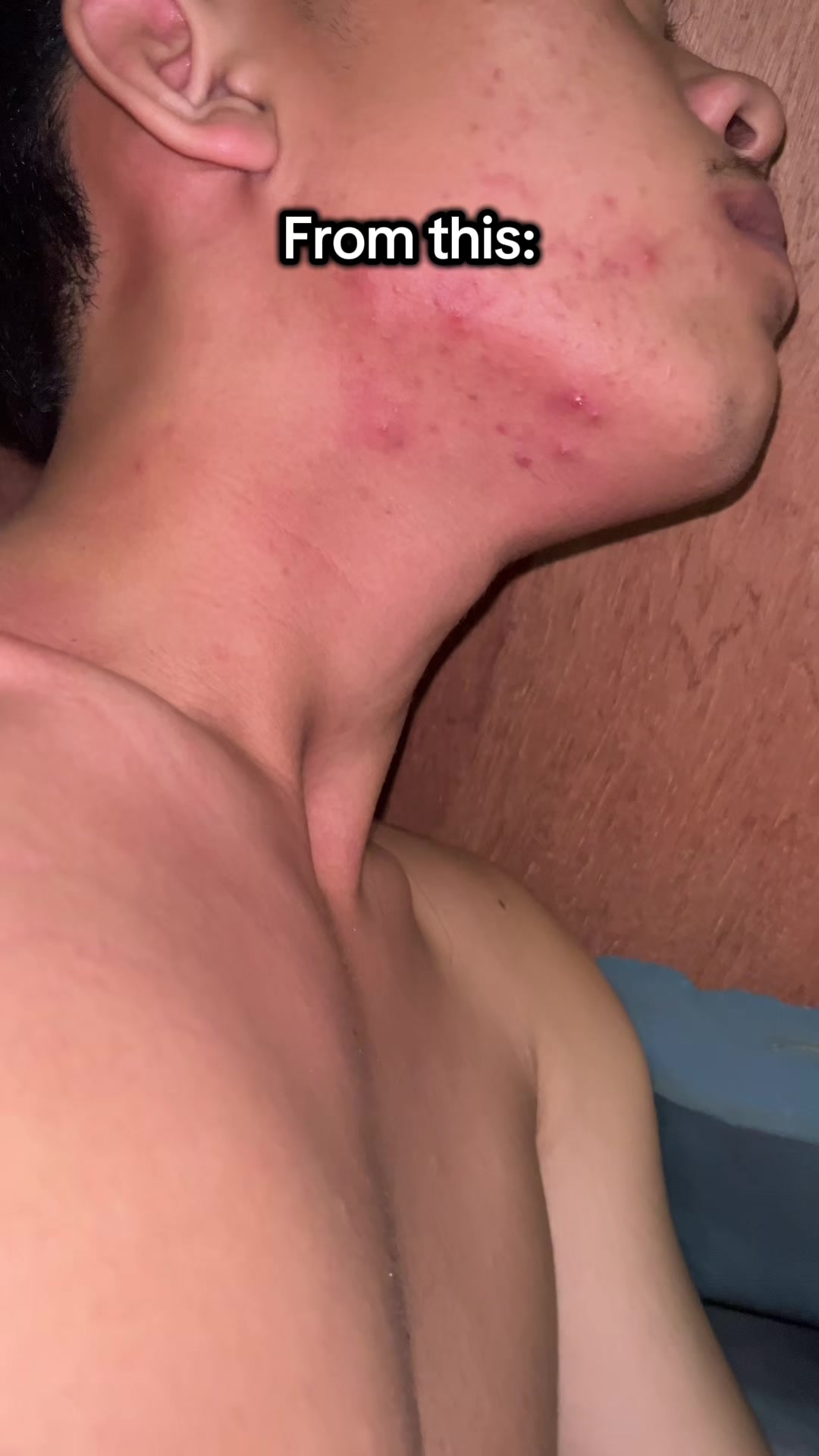 @elmxr