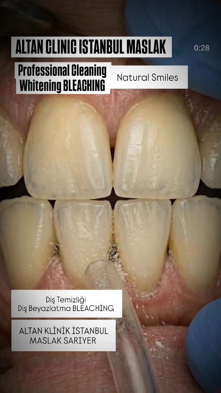@DişHekimi Fikret Altan Dentist