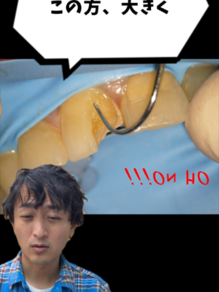@金歯先生☆歯医者