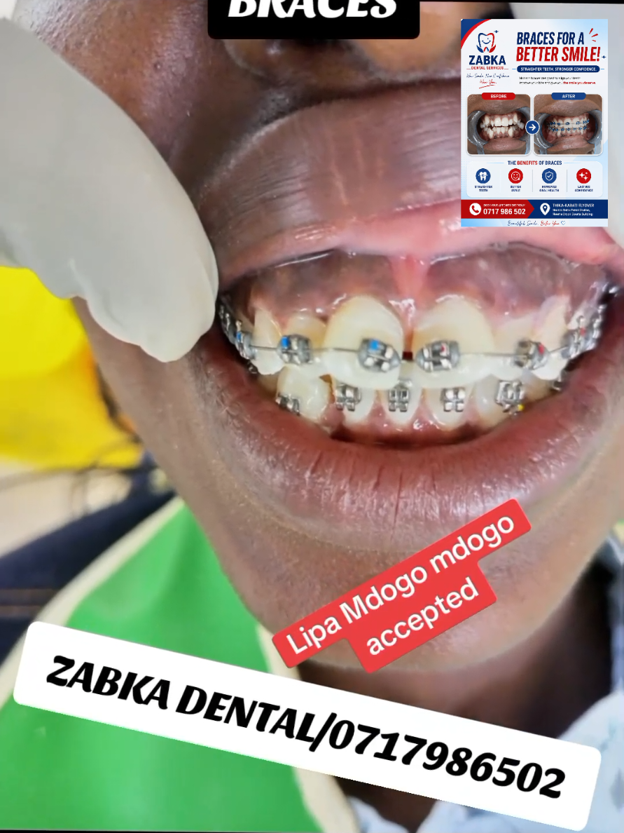 @Zabka Dental