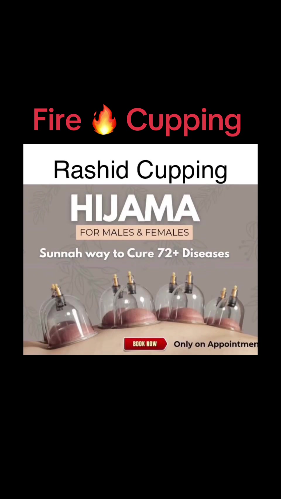 @Rashid 🇿🇦 🇵🇰Hijama Cupping