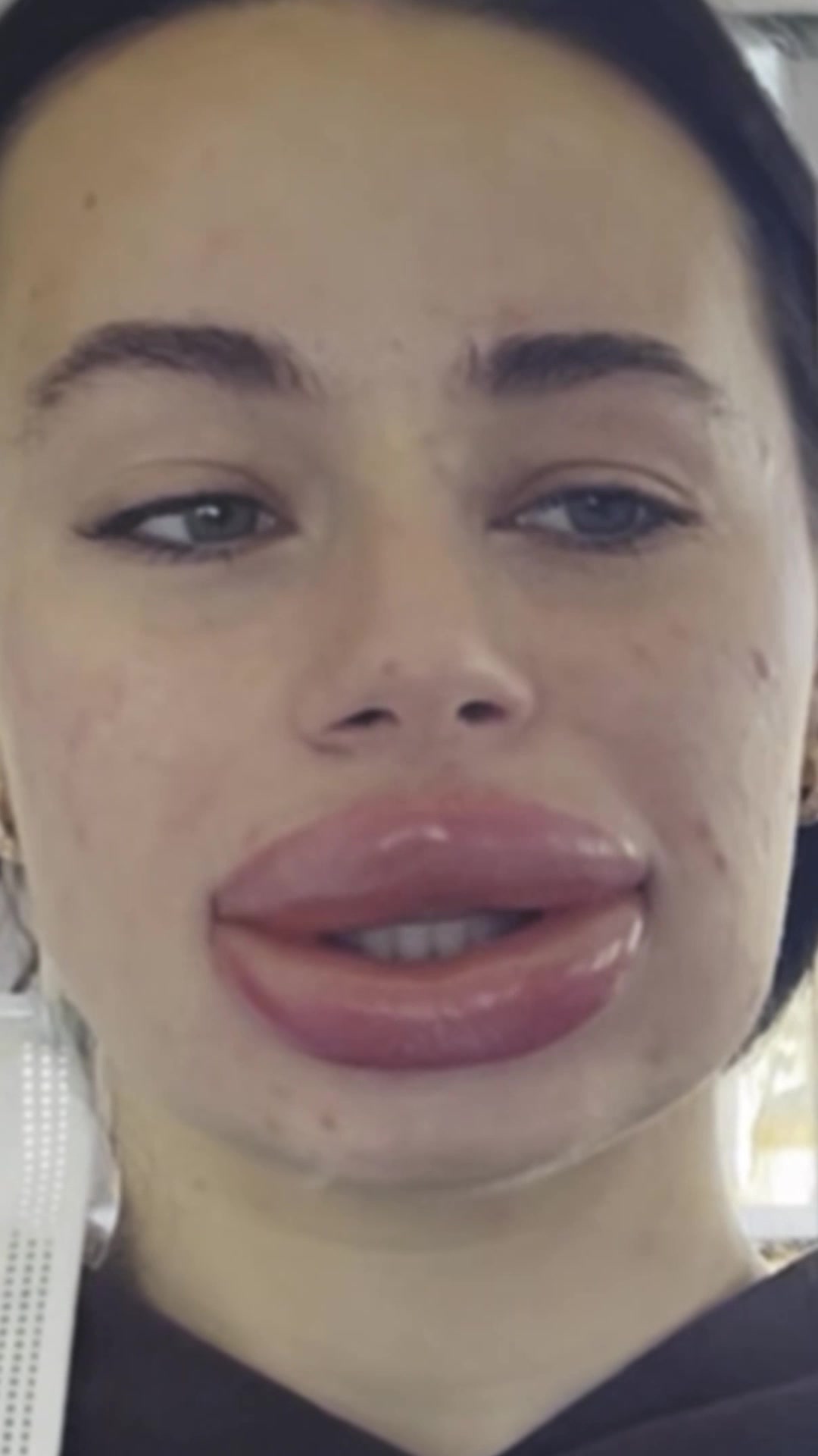 @tlc