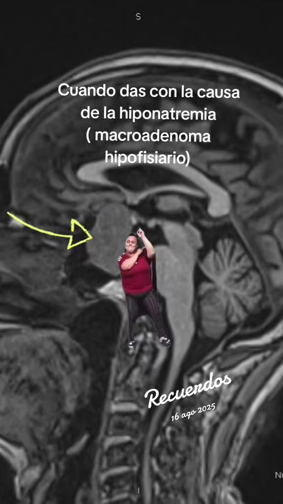 @Dr. Ajolote.