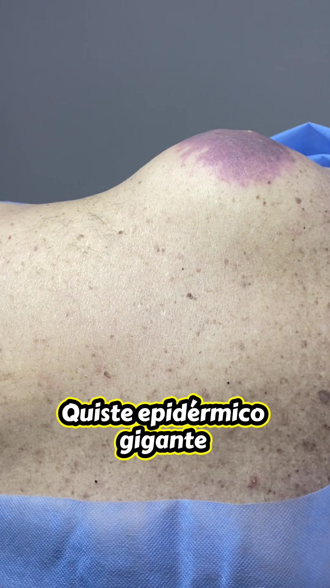 @dr.idrogodermatologo