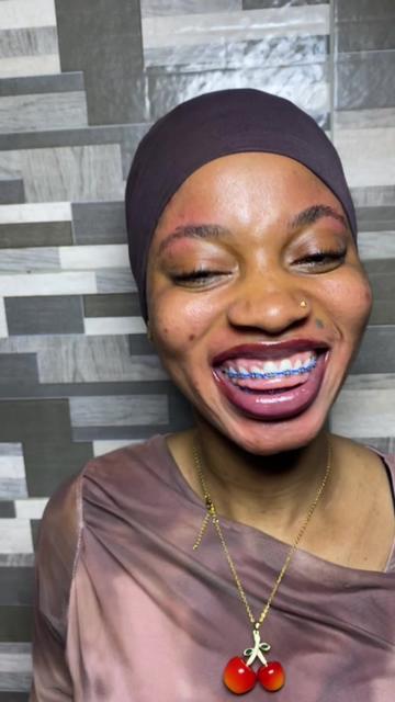@Braces.bymavi|Smile Aesthetics