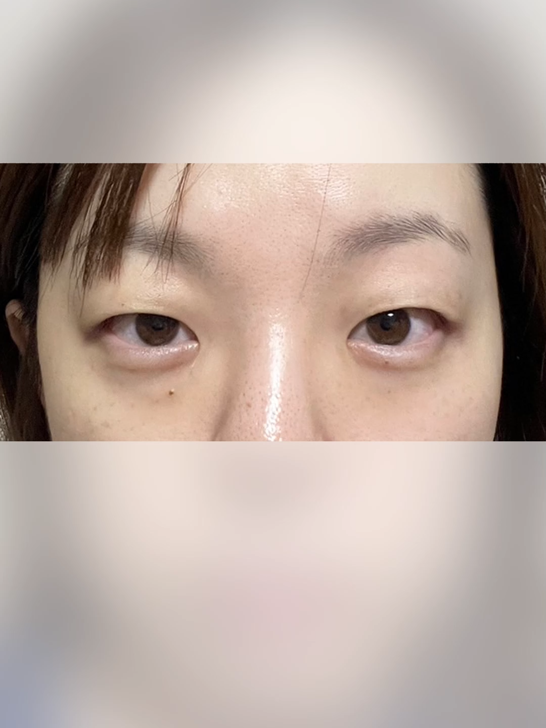@다시피움성형외과 DASIPIUM タシピウム