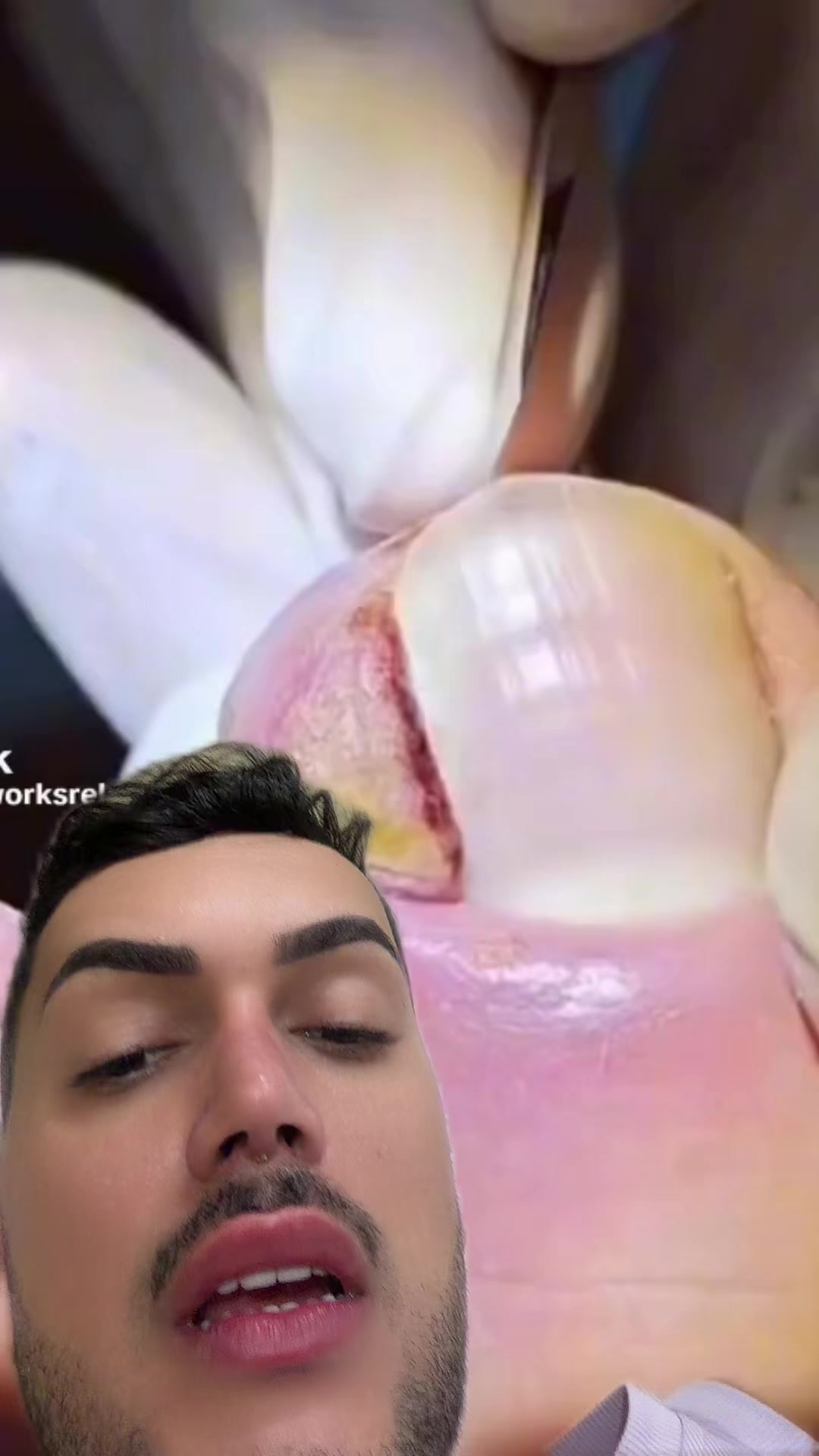 @Alex costa