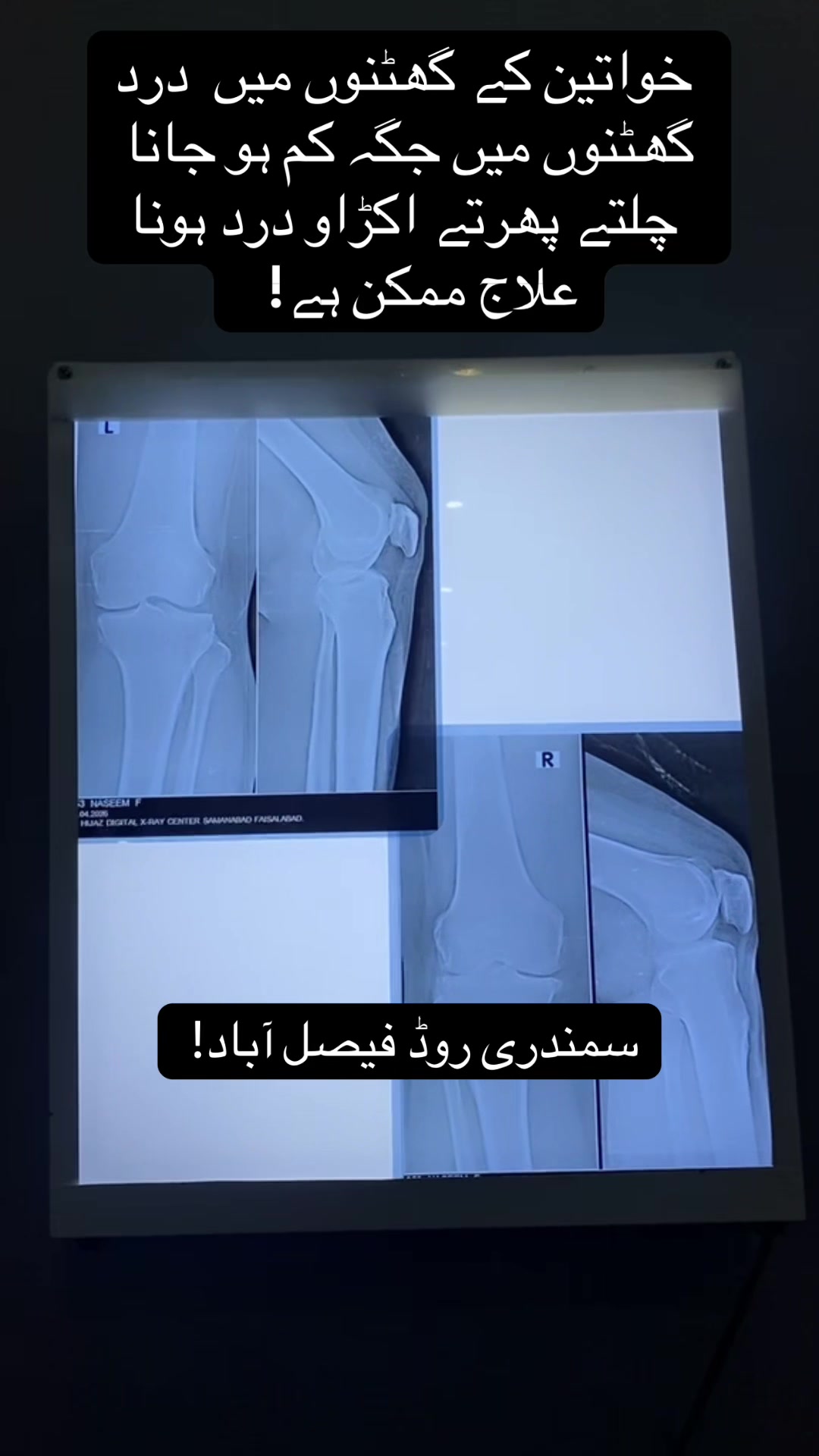 @Hamza Hessam Physio Clinic.