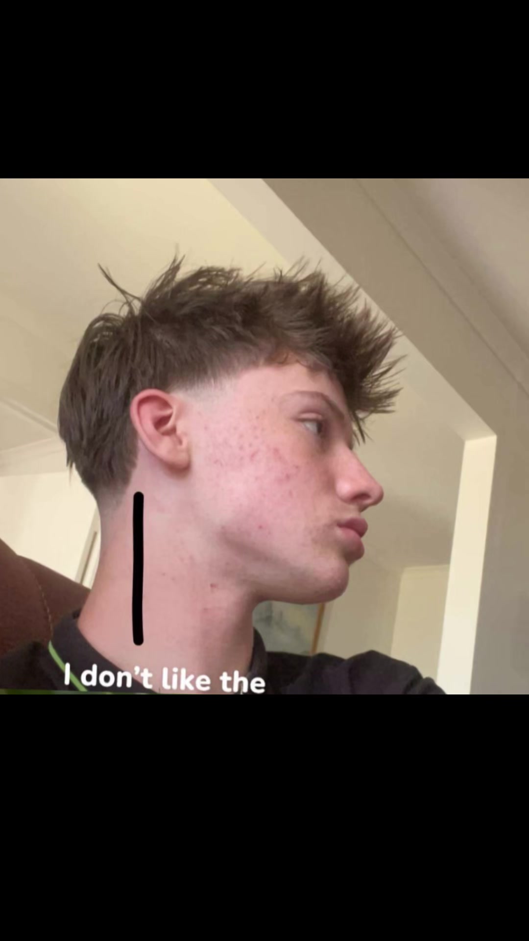 @Ant