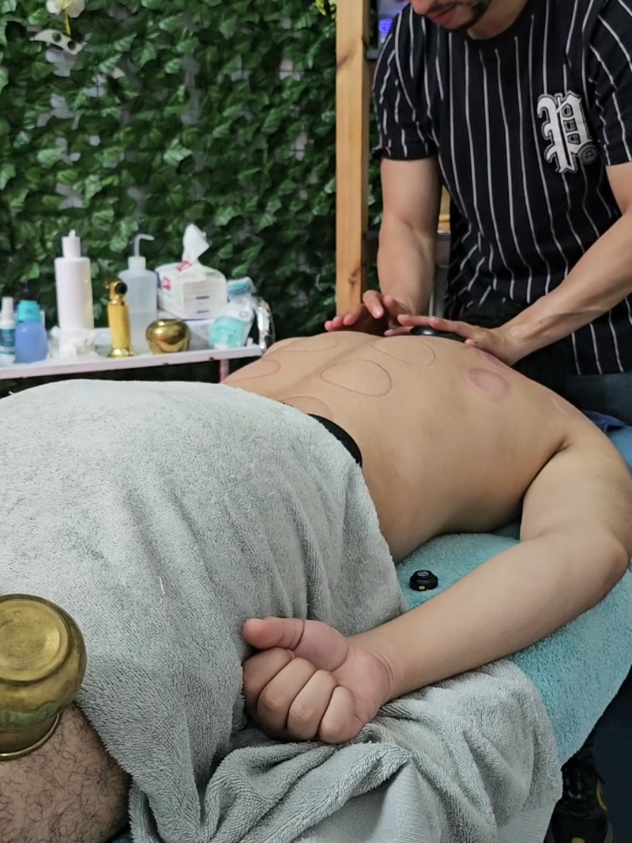 @Hijama_massage_Titmellil