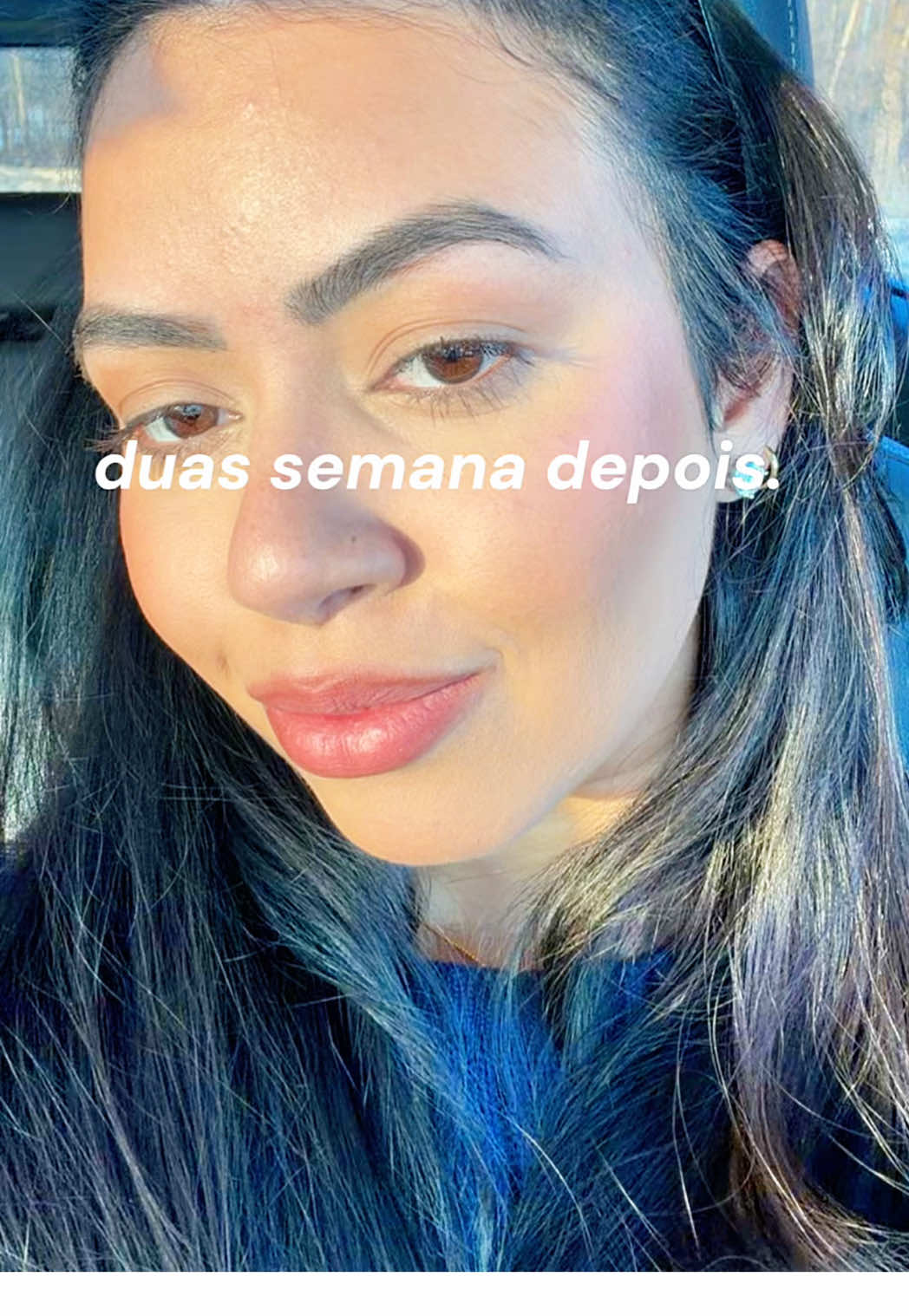 @bea