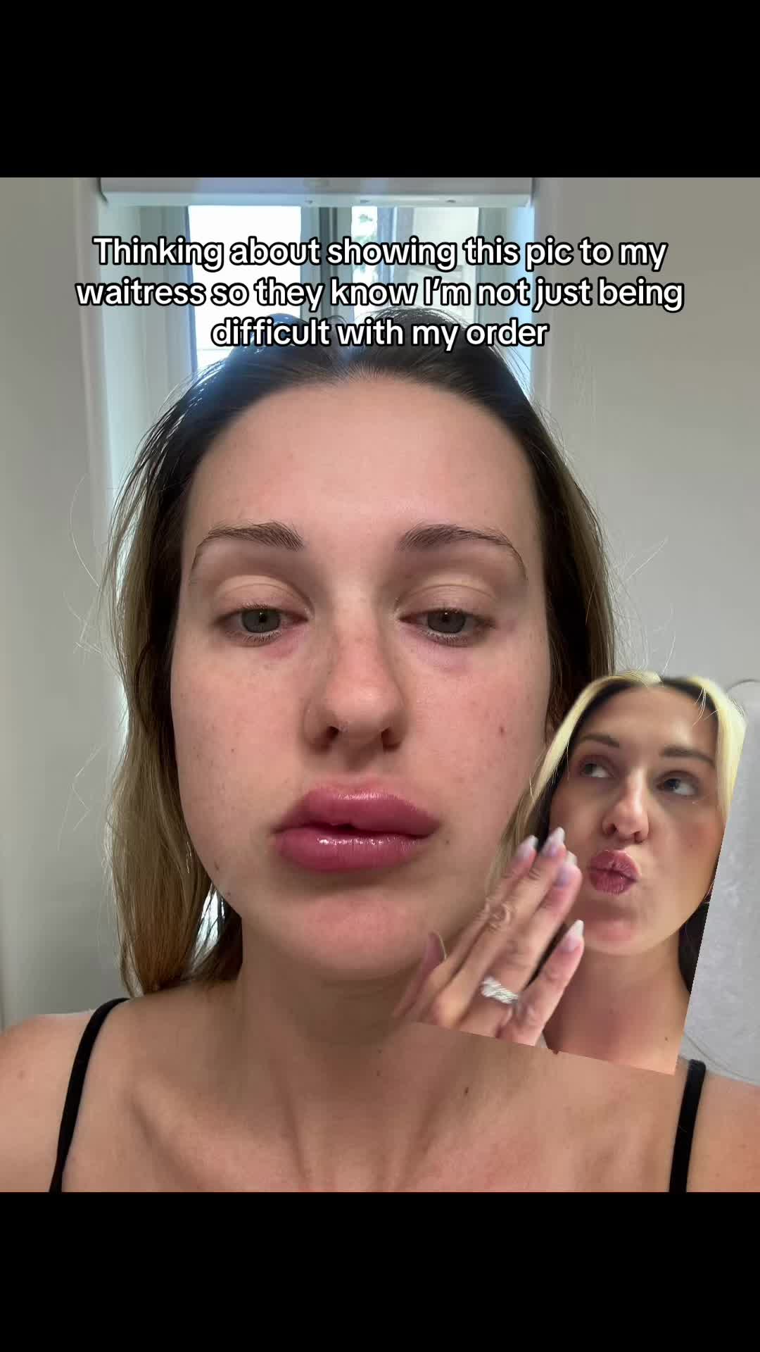@allergygirl_