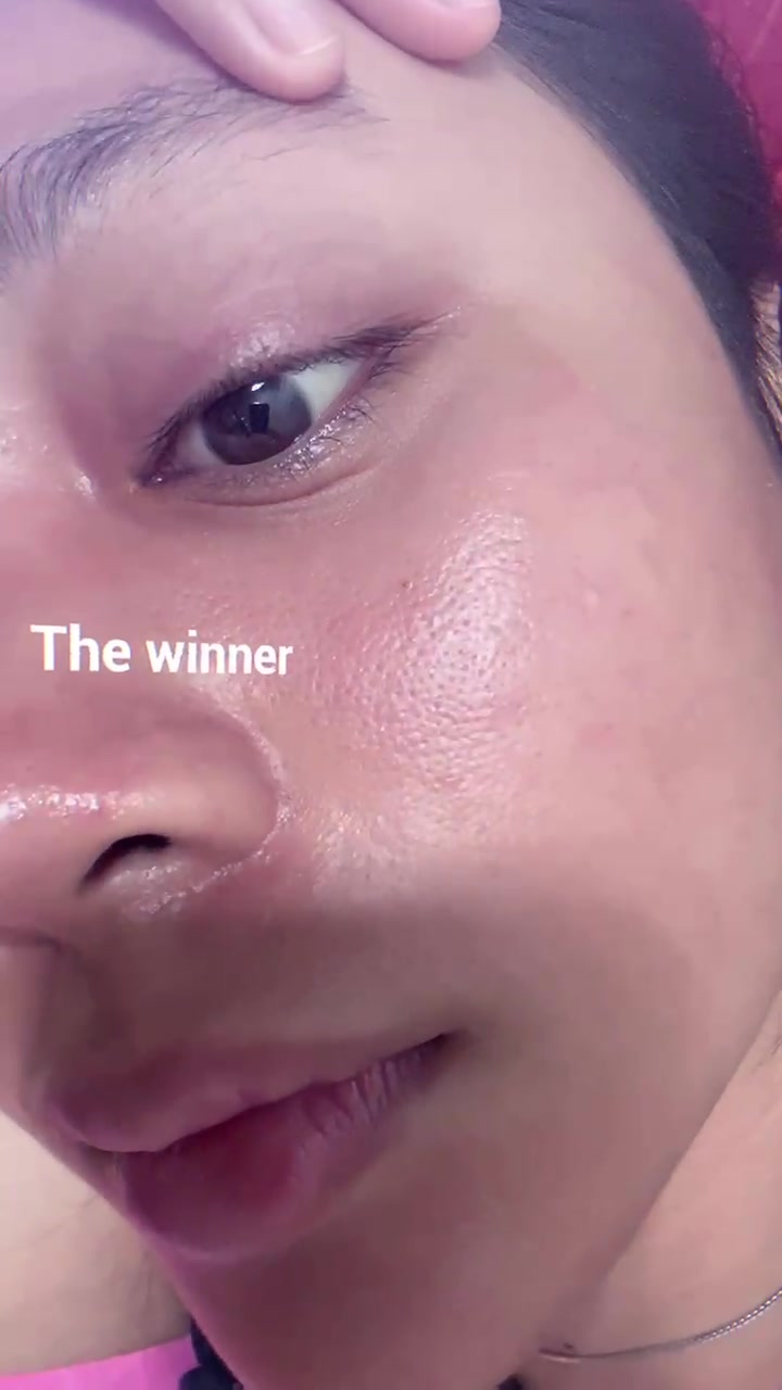 @klamite