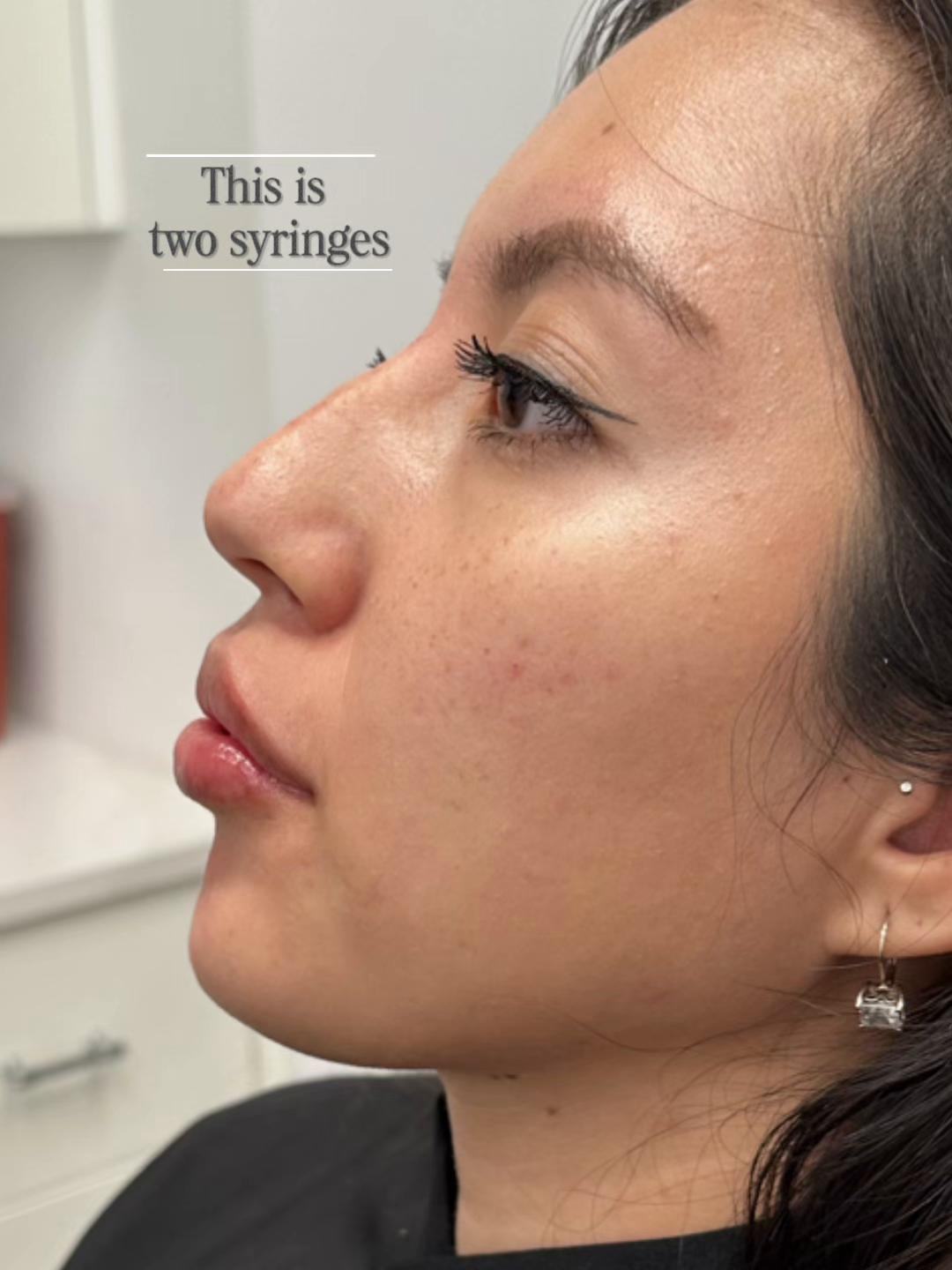 @Rosedermnyc