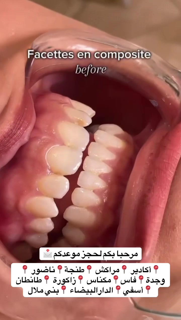 @brightsmileee1