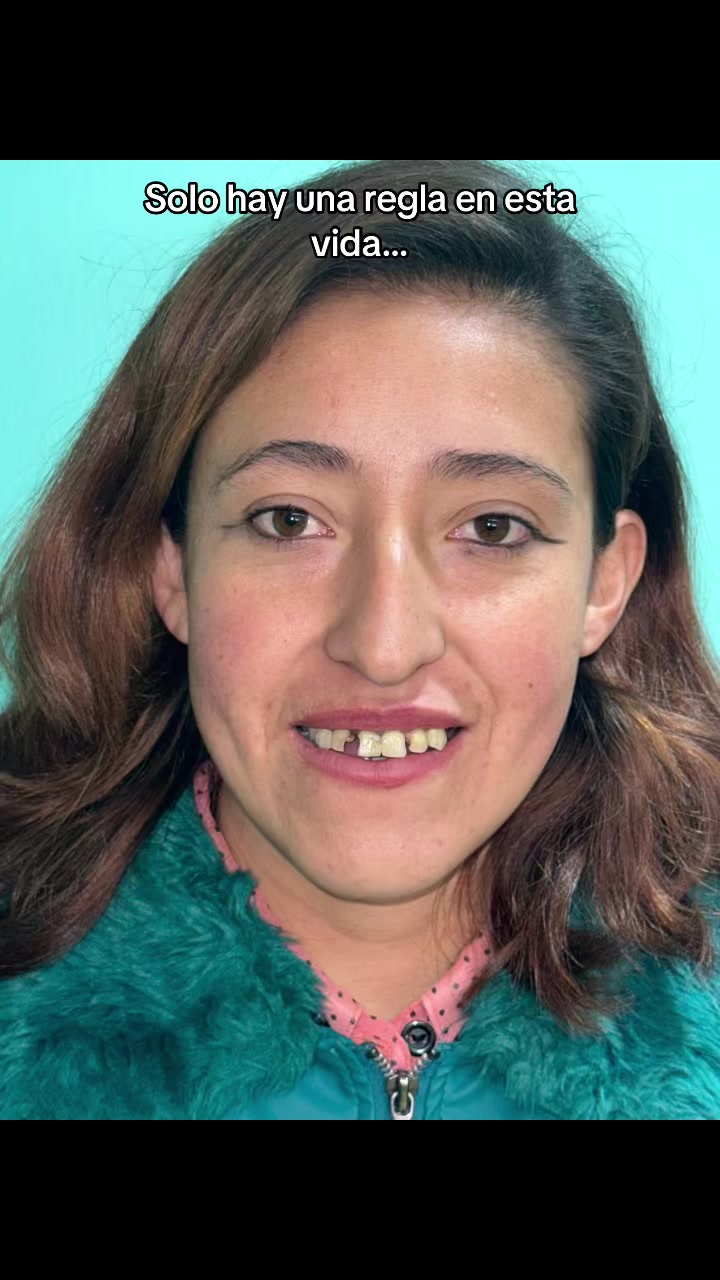 @GabeApreza