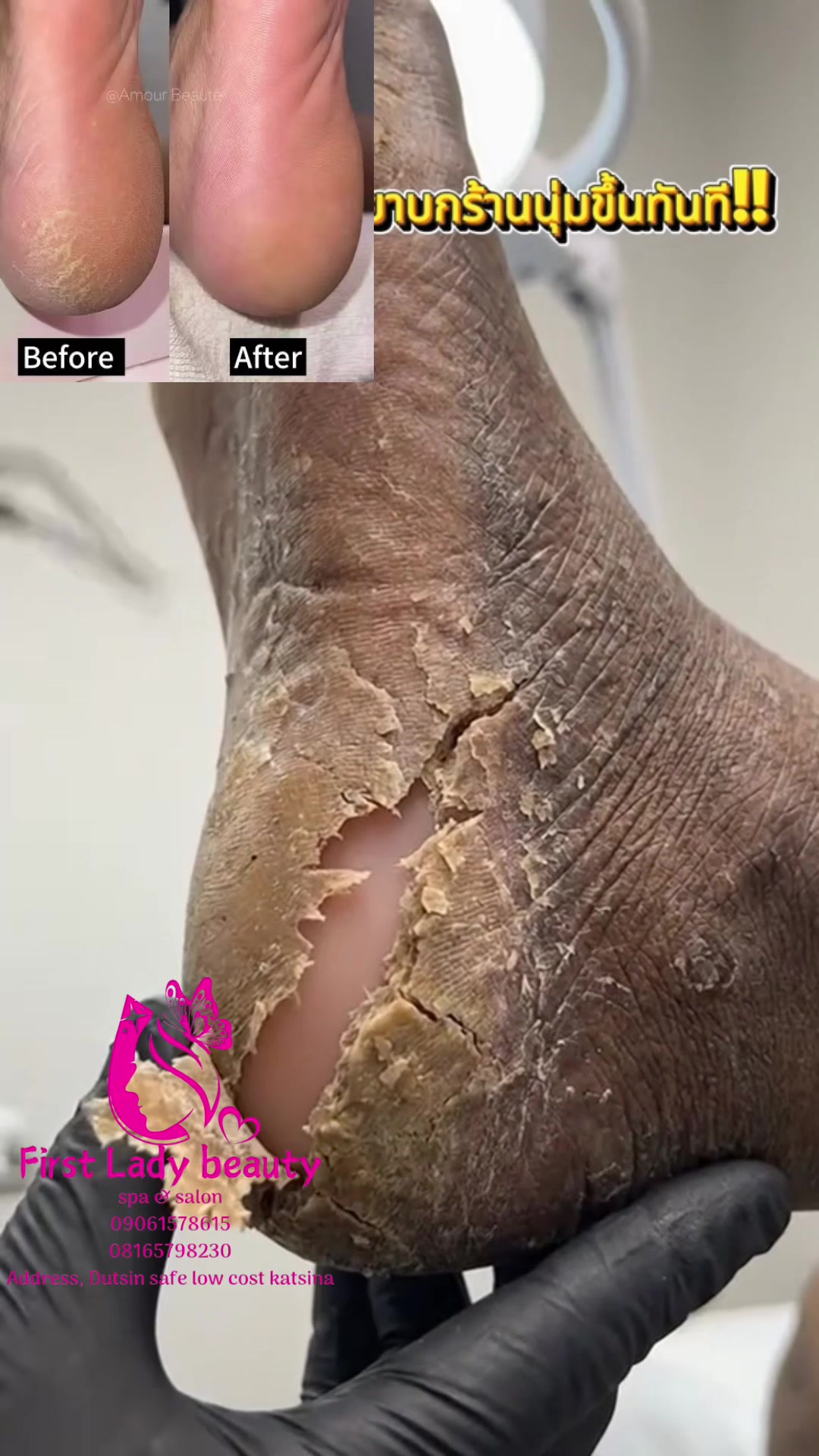 @Hair and skin solution