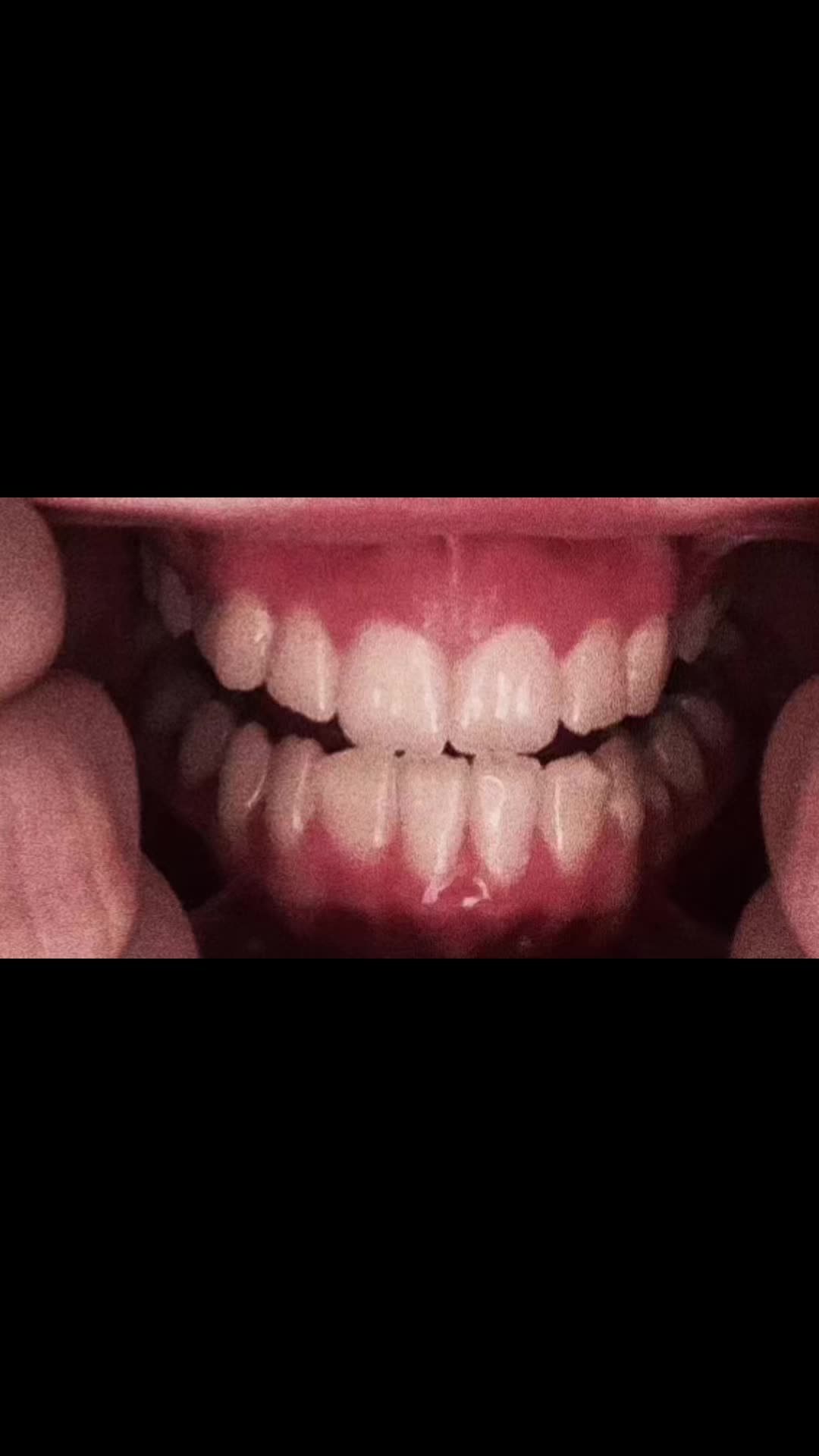 @teeetharecool