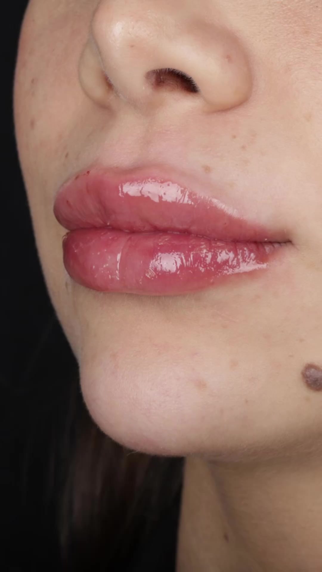 @Dr Fatma ElFradi Dermatologist