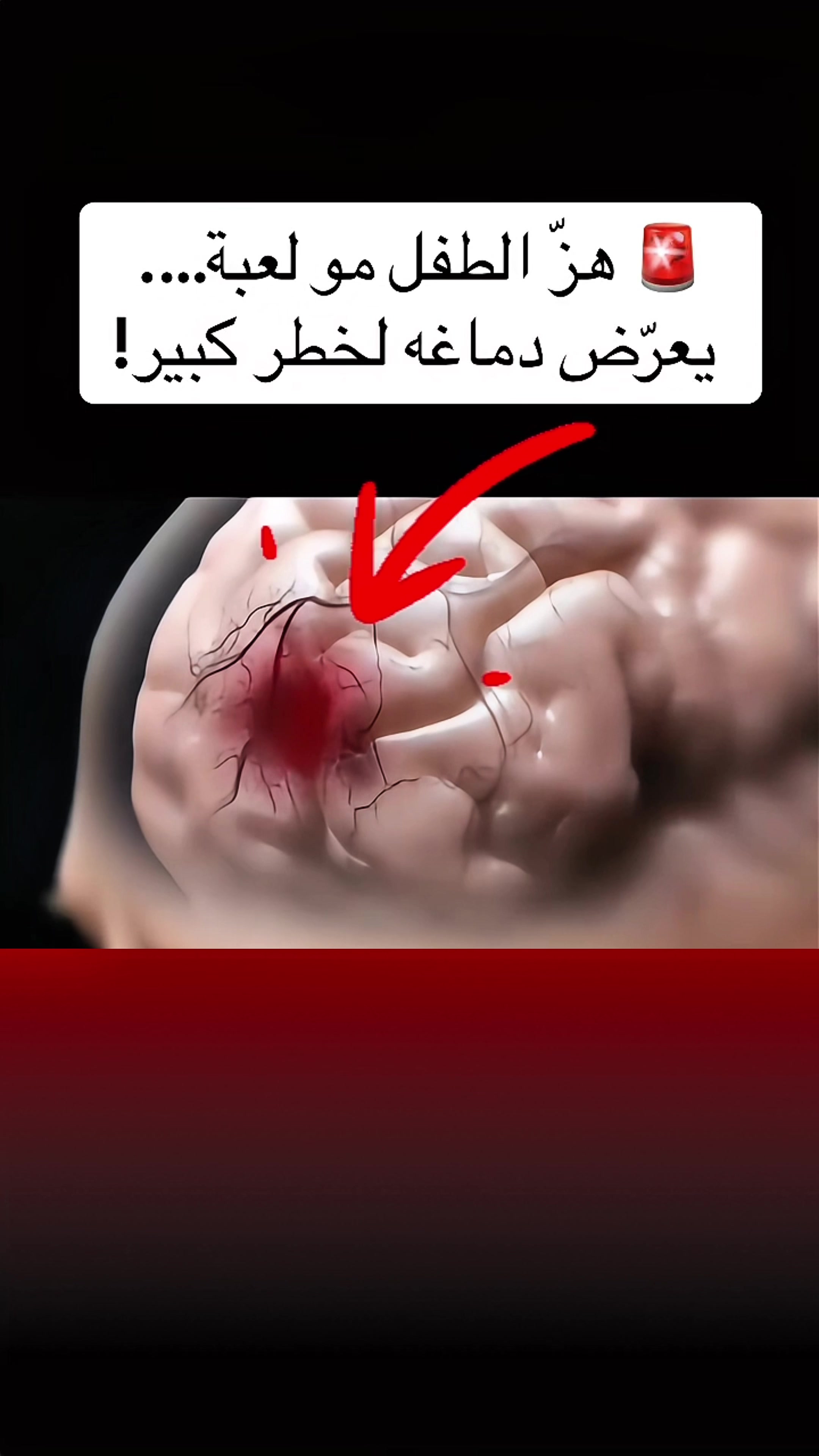 @طبيب تيك توك🩺💊💉