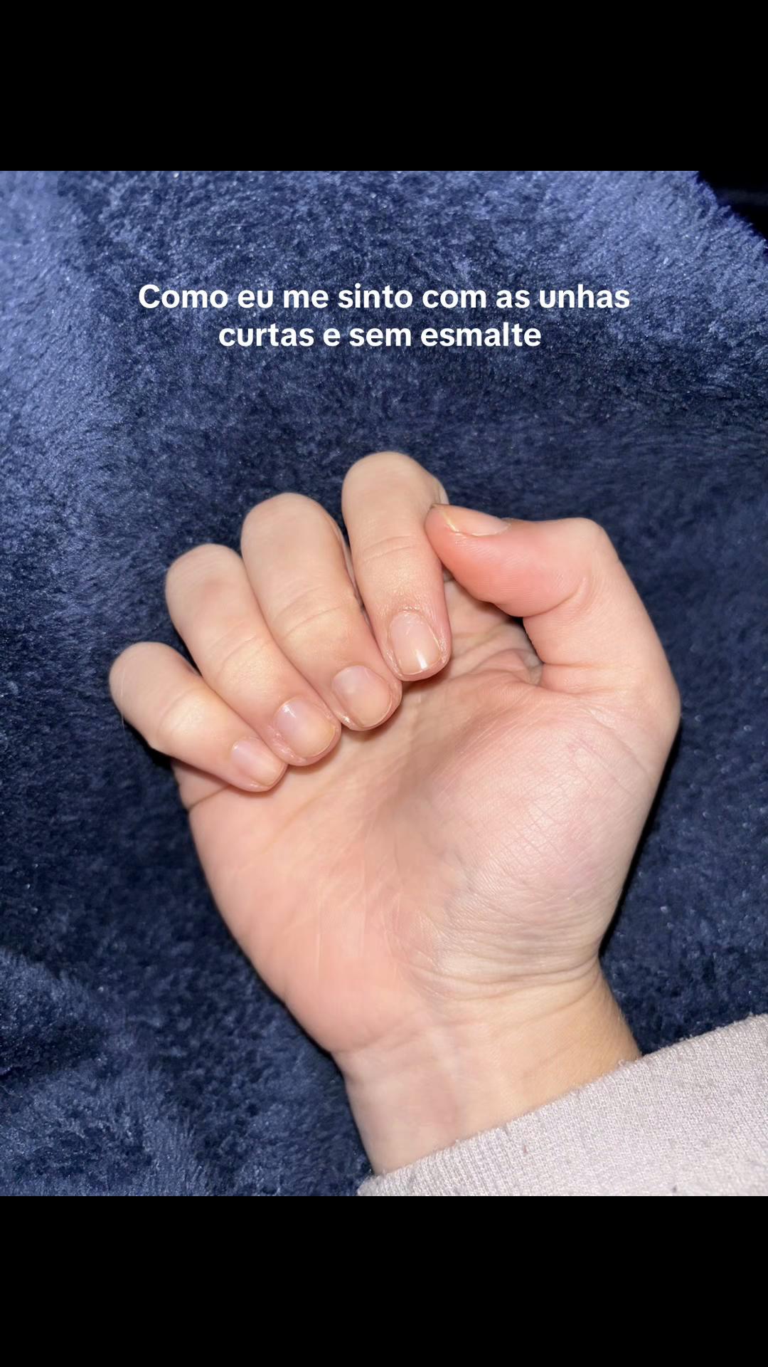 @não é a Ana 🙄