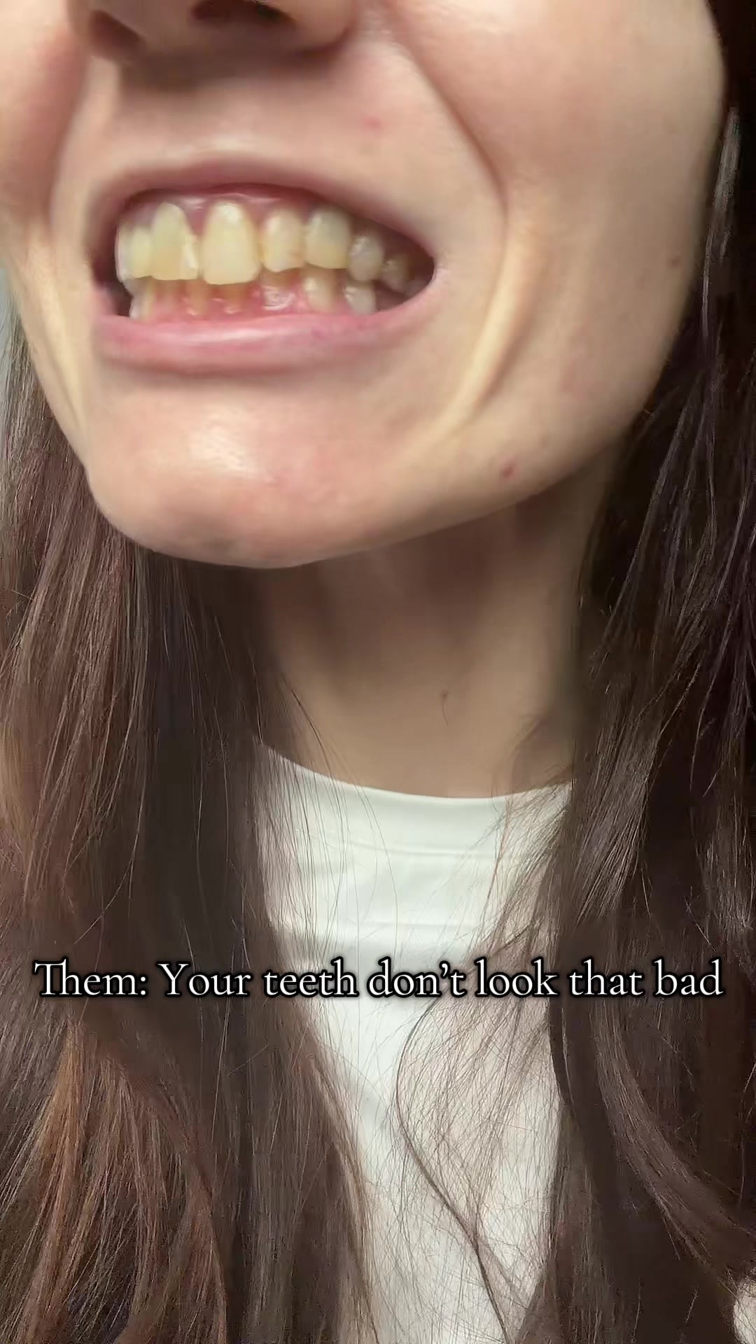 @Taylor Toothtales 🦷