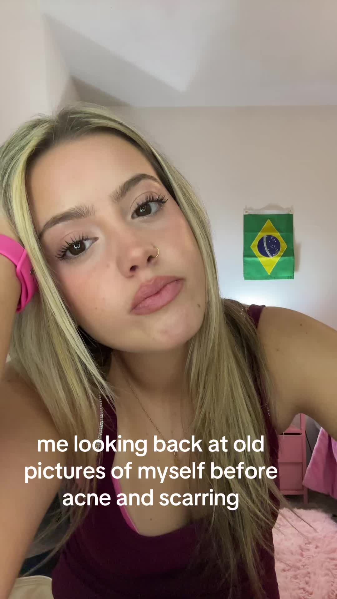 @cheeto🙈
