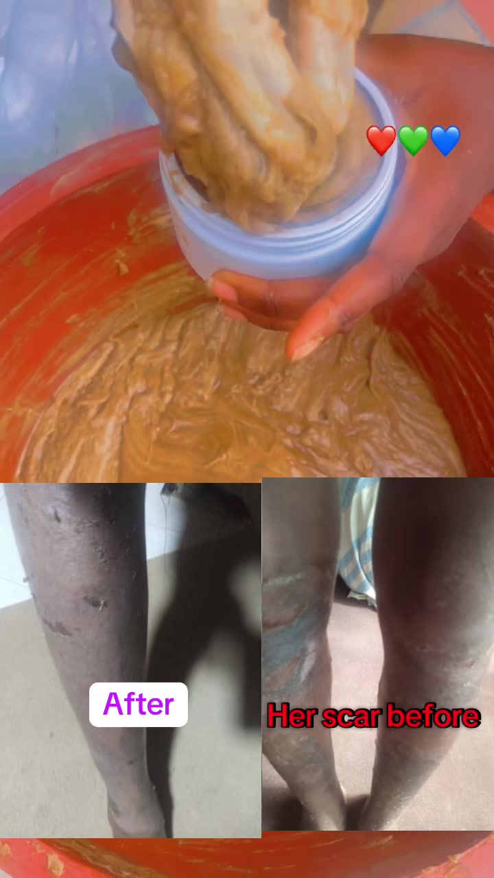@@ Precious peeling soap