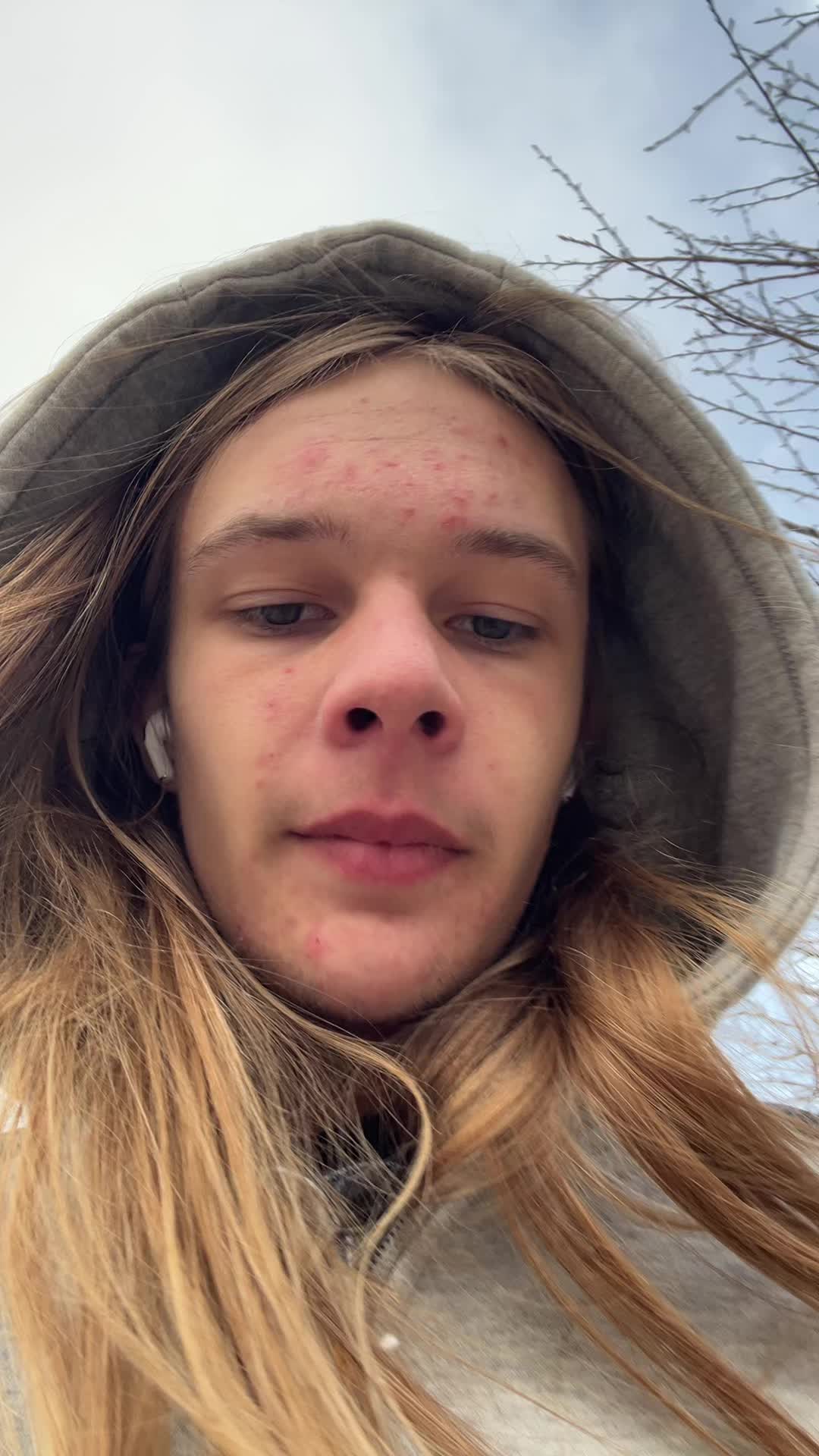 @FriedEpilepic
