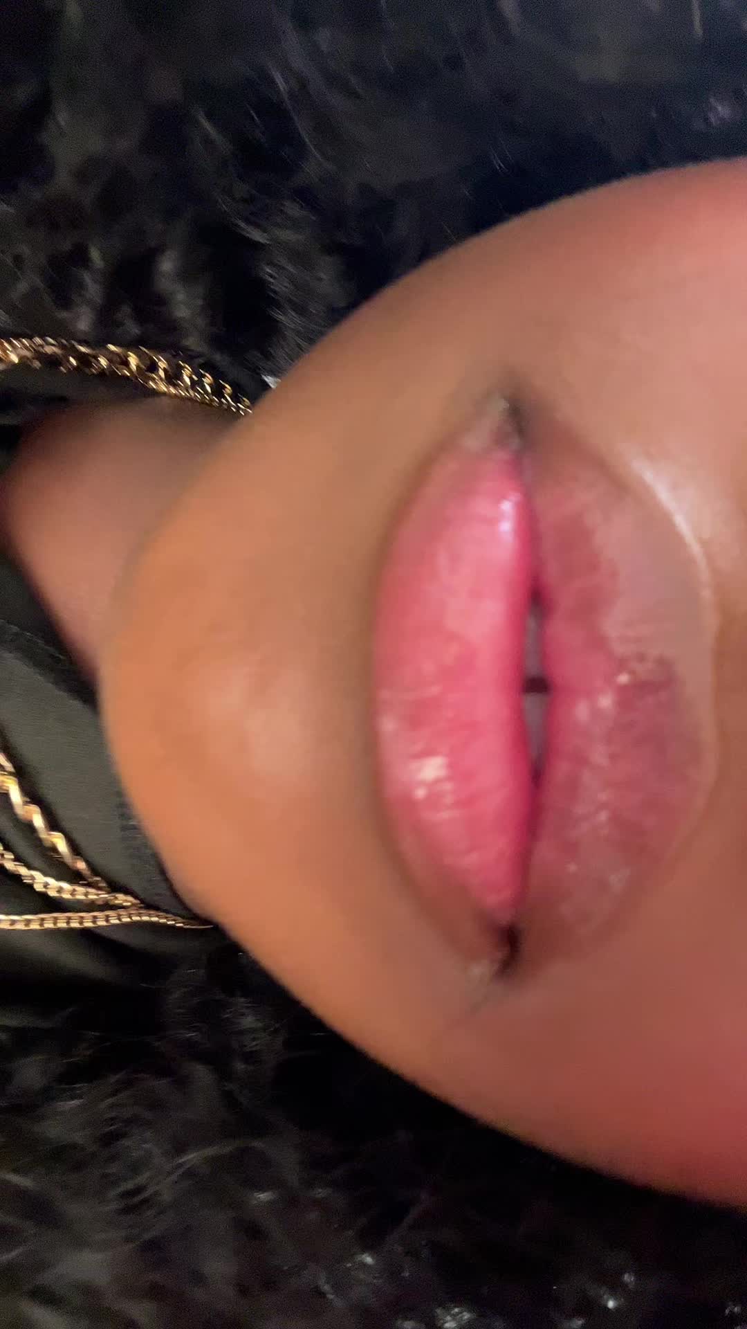 @Notlanadc