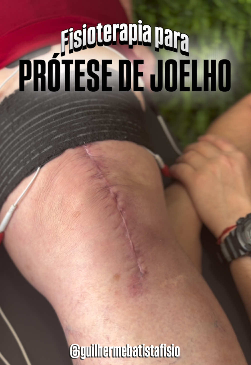 @Dr Guilherme Batista