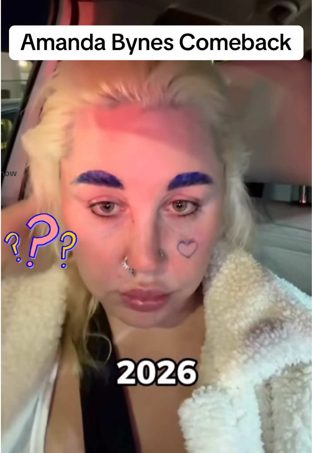 @cinder1987