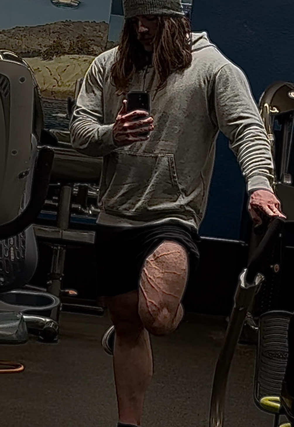 @LucasFit